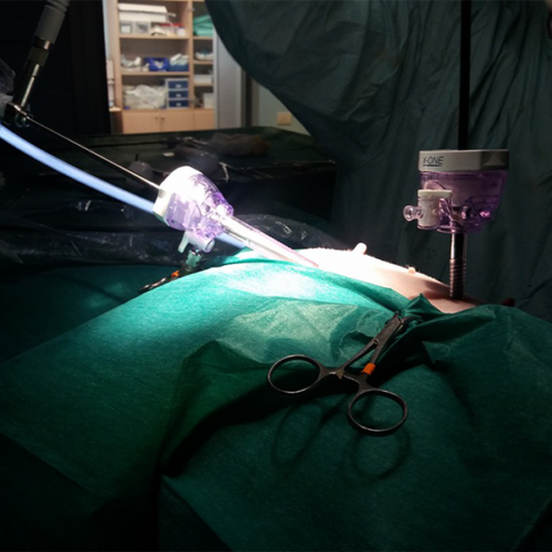 Chirurgia Laparoscopica